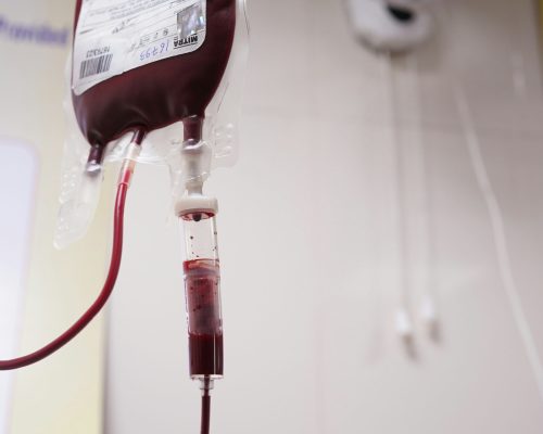 aman-chaturvedi-0ZZo5o00o80-unsplash